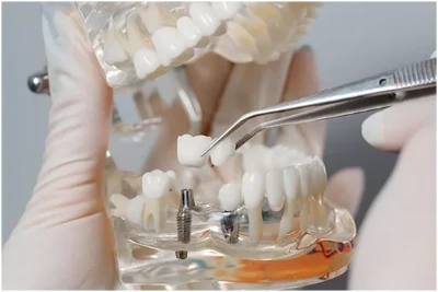 Dental Dental